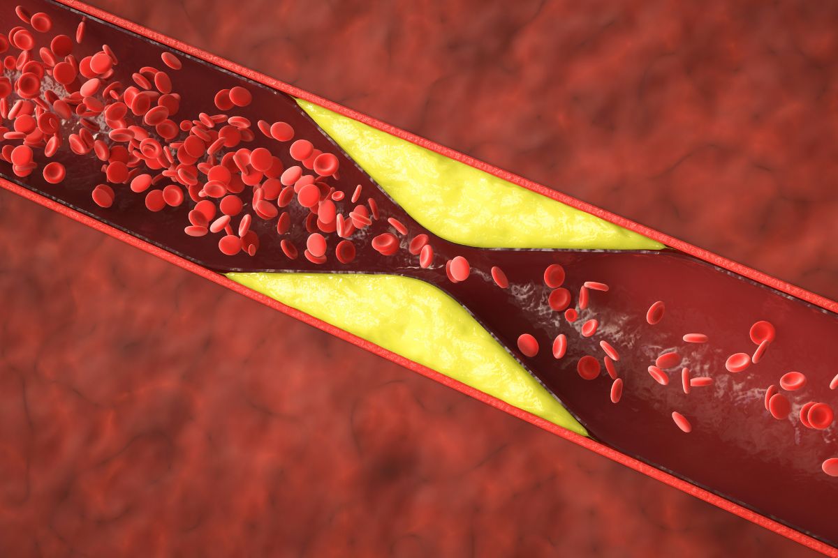 16 maisto produktų, mažinančių cholesterolio kiekį, kad jūsų arterijos būtų švarios