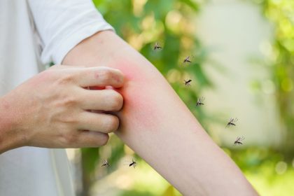 Kodėl uodai lenda būtent prie jūsų? 6 dažniausios priežastys