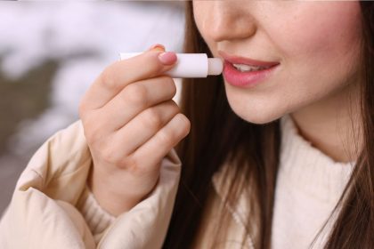 Kodėl per dažnai naudojamas lūpų balzamas gali pakenkti: dermatologų perspėjimai ir natūralus sprendimas