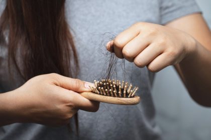 Plaukų slinkimas: kaip suprasti, ar netenkate per daug plaukų ir ką daryti