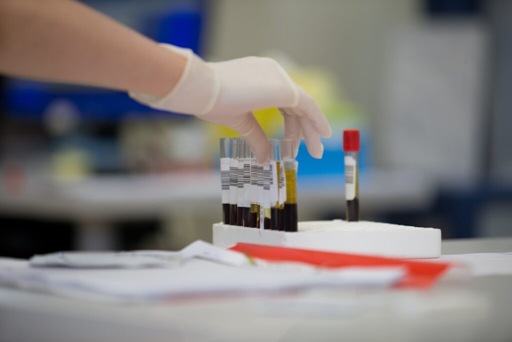 a gloved hand holding a test tube filled with blood