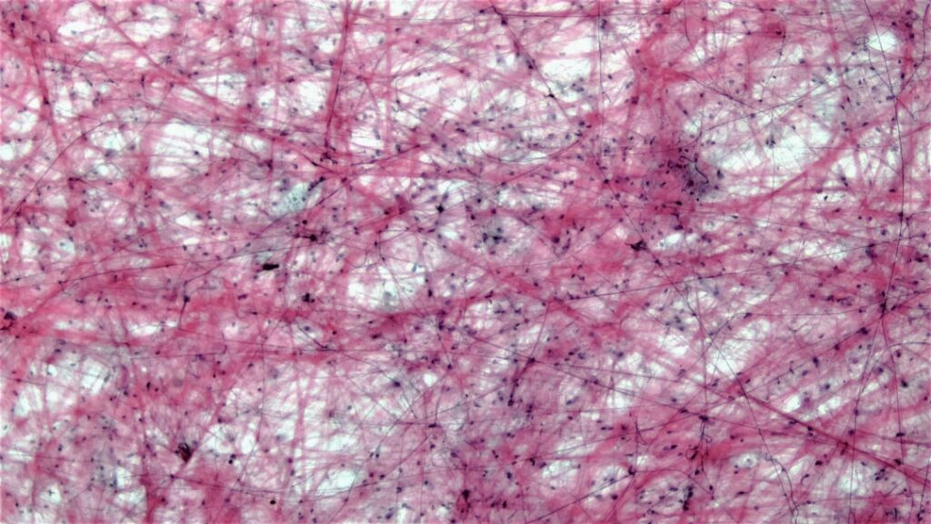 Microscopic view of pink fibers and dark dots.