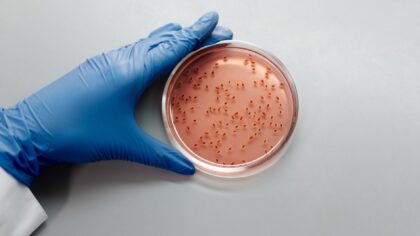 Kaip bakterijos suvalgo plastiką? Laboratorijose gimsta netikėtas taršos mažinimo įrankis